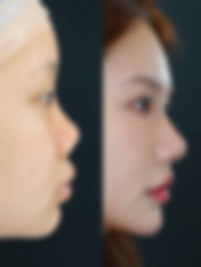 【上海颜净整形医院怎么预约挂号?】