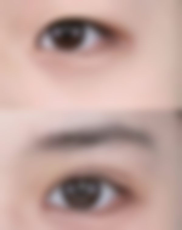 种植头发真的可以自然生长吗