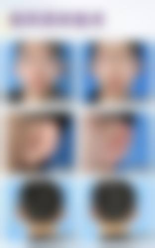 【郑州大桥医院医疗美容科诊疗设备:】