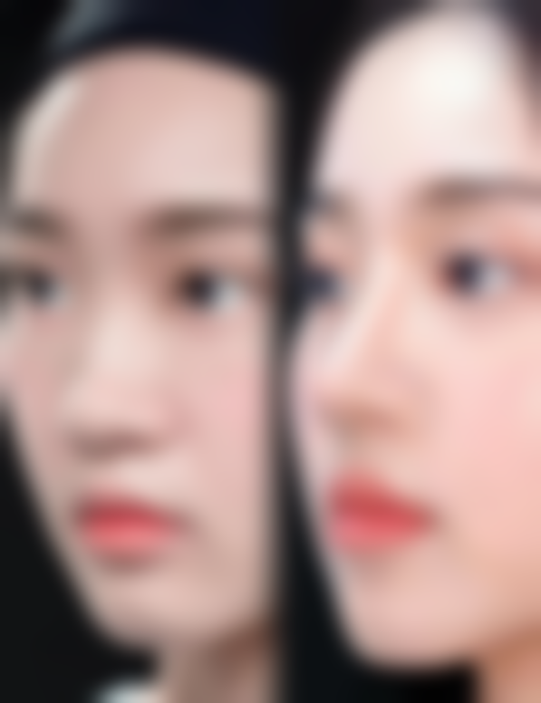 【韩国S - ONE整形美容中 心特色项目：】