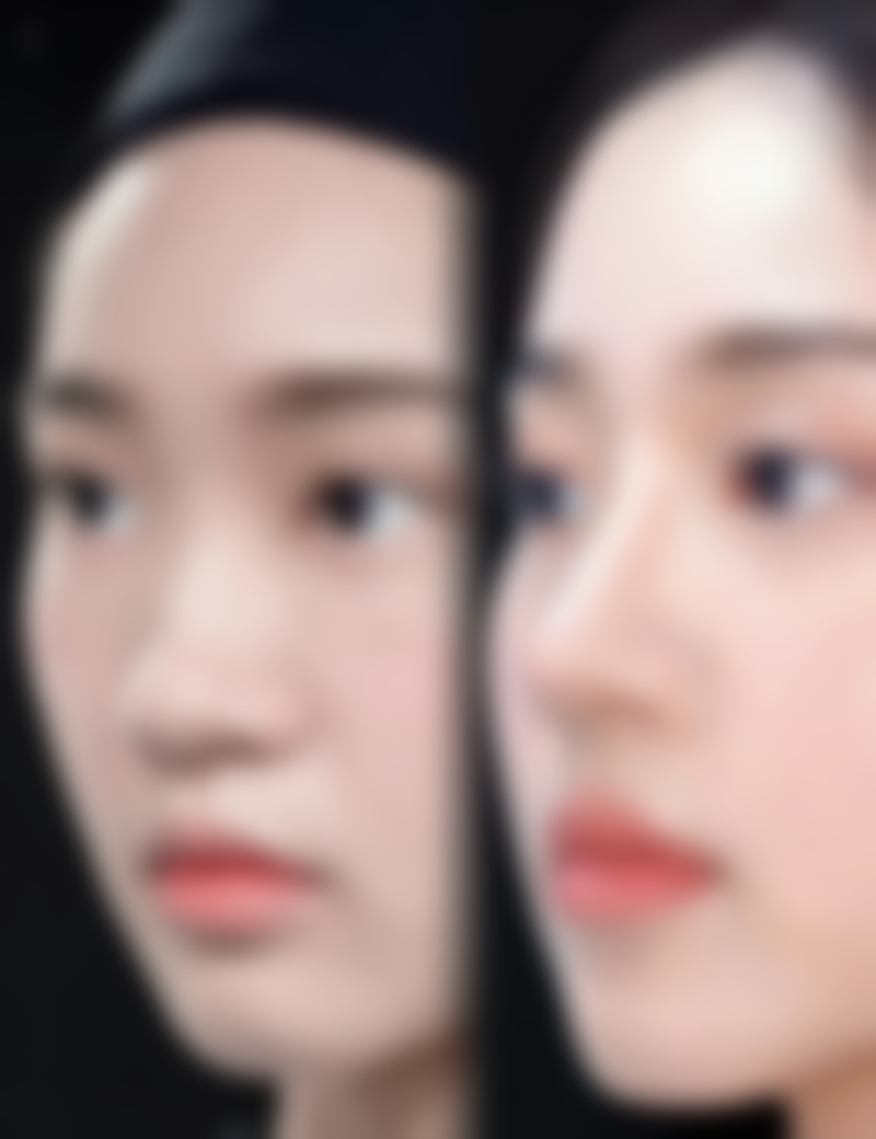 【郑州精蝶轻颜塑整形医院参考价格表：】