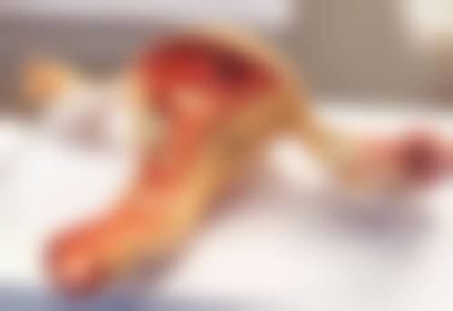 下颌角手术后嘴巴特别肿怎么办？