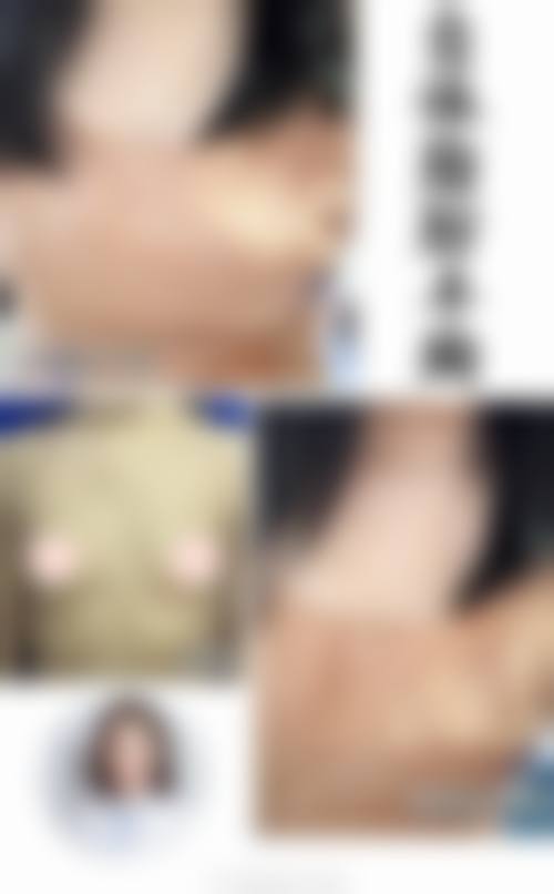 【丽水樊承红整形医院患者口碑评价：】