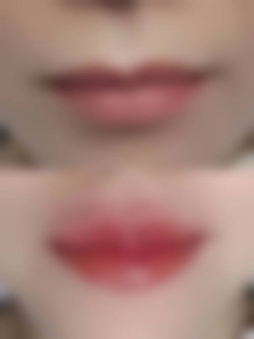 【浠水县悦颜整形医院地址：】