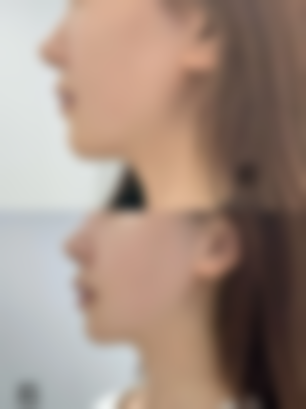 【张建林医生口碑】