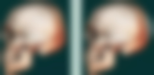 【韩国dr.bone整形外科是正规的吗?】