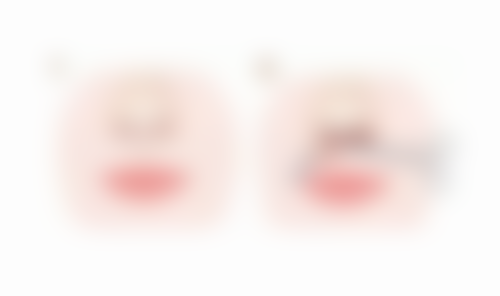 瘦脸针间隔多久打一次更好