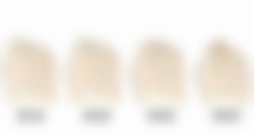 种植毛发一般多少钱一次？不同项目价格大比拼