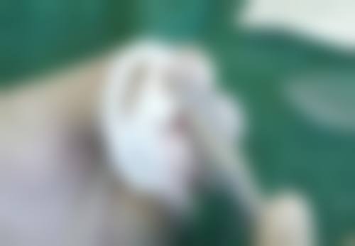 种植头发能生长吗？真的可以自然生长吗？