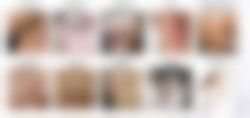 头发种植能保持多久时间