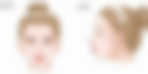 四、发际线种植多少钱