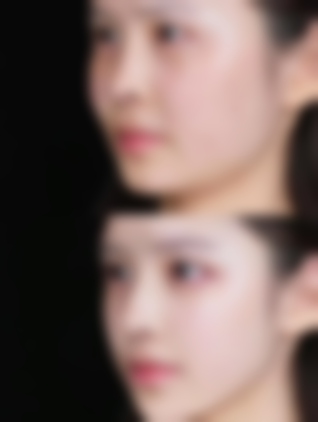 种植毛发一般多少钱？影响因素大揭秘