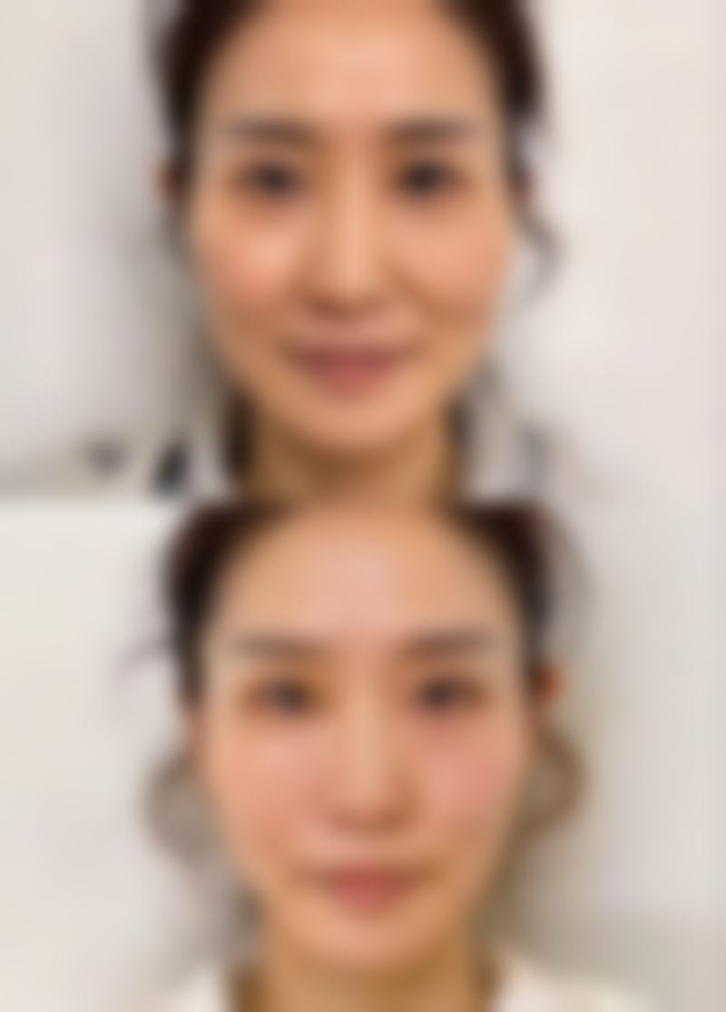 头发越来越少，吃中药能调理好吗