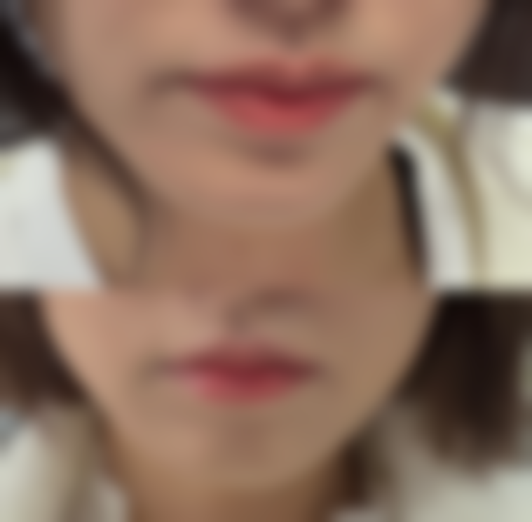 【湘潭市中 心医院(整形创疡烧伤科湘潭市创面伤口修复中 心)地址：】