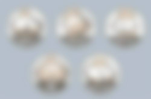 种植发际线技术