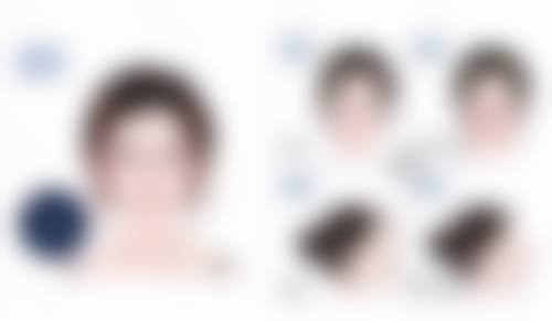 怎么样去丰太阳穴？掌握玻尿酸、自体脂肪填充等3种常见方法，轻松拥有饱满太阳穴！ 