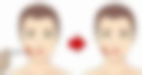 除皱针的价格一般是多少