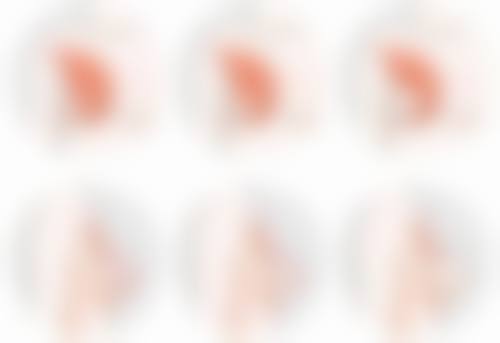 打完瘦脸针后嘴巴歪了