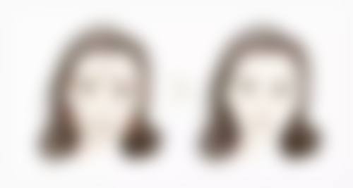 除皱针一般多久打一次更好