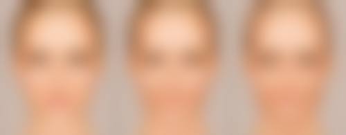 种植头发能维持几年