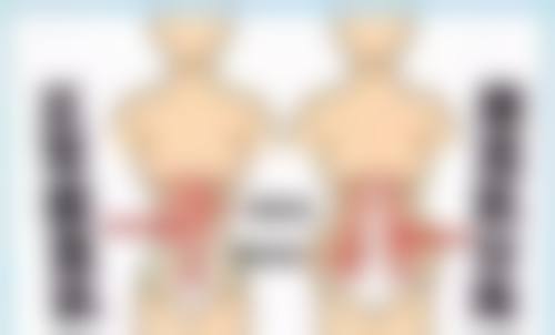 小阴唇缩小手术的修复时间