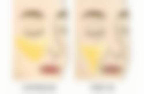 种植头发能保持多久