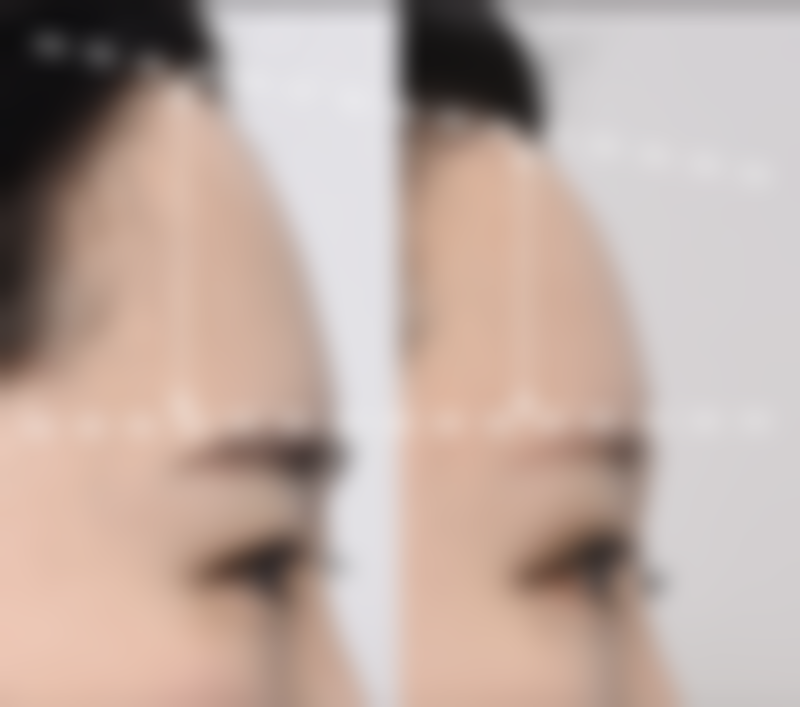 种植头发能生长吗