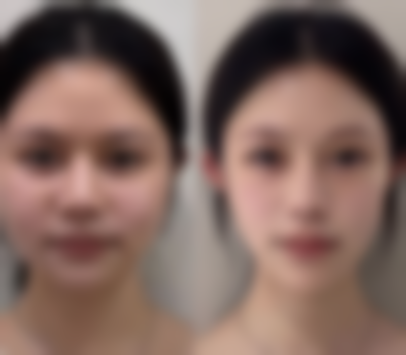 【 常州虹雅医疗美容诊所患者口碑评价：】