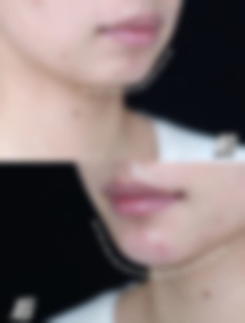 【深圳嘎纳医疗美容门诊部参考价格表：】