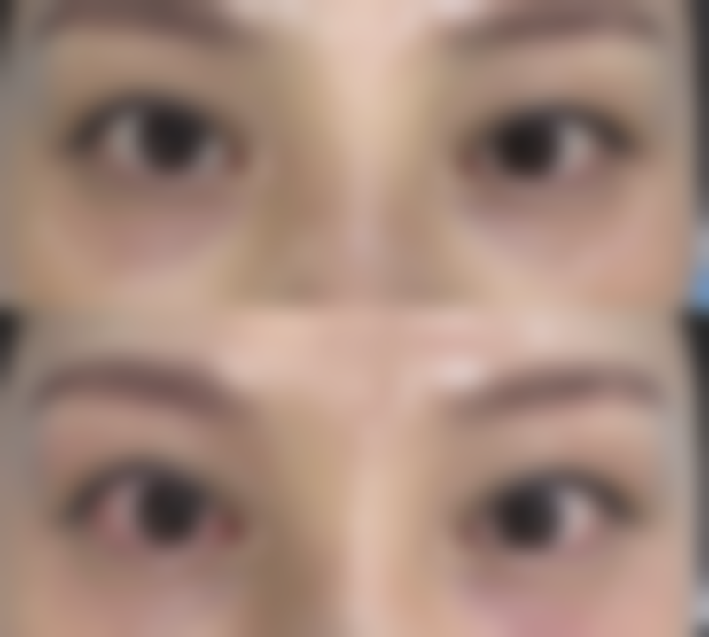 【厦门SOR祛痘医院(SM城市广场店)参考价格表：】