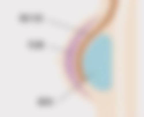 美学与安心建议