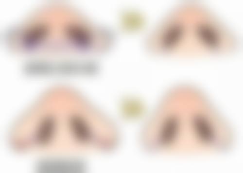 打了瘦脸针以后不打会不会反弹更大