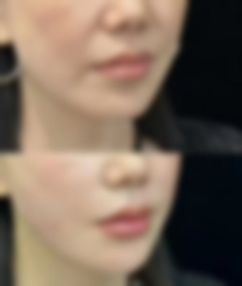 患者可通过电话或医院法定网站进行预约,具体的联系方式可以在医院官网获取。这样的预约方式特别便捷,大家可以提前安排好自己的就诊时间,避免排队等待的麻烦。