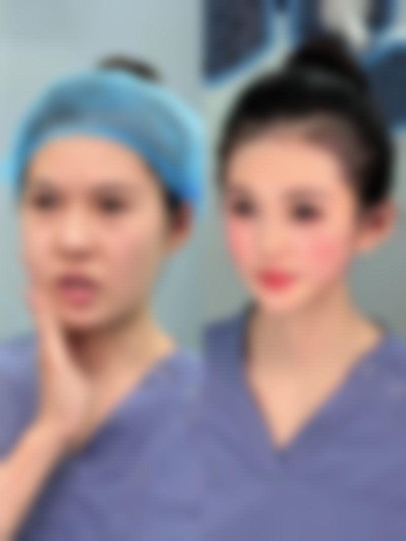 嘴唇疤痕修复手术一般多少钱