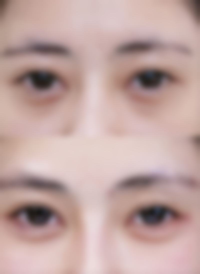 【大理瑞心医疗美容诊所特色项目:】