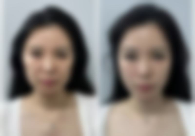 国内外有名美白针品牌