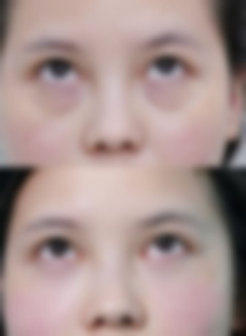 特殊体质需警惕