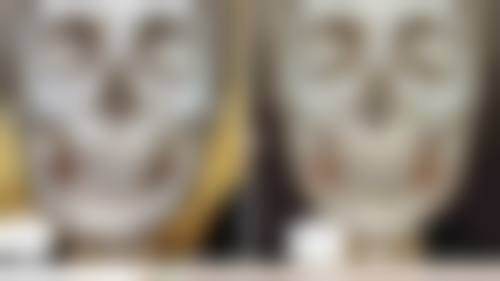 美白针可以打吗？有什么后遗症吗