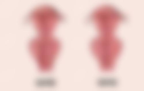 美白针后遗症图片解析