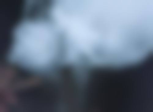 4000个毛囊植发的价格