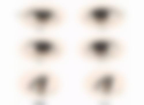 头发种植多久有成效