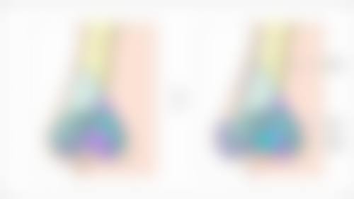 打除皱针有没有什么副作用啊？了解常见 3 大潜在风险及 5 大应对措施，让你除皱更安心！ 