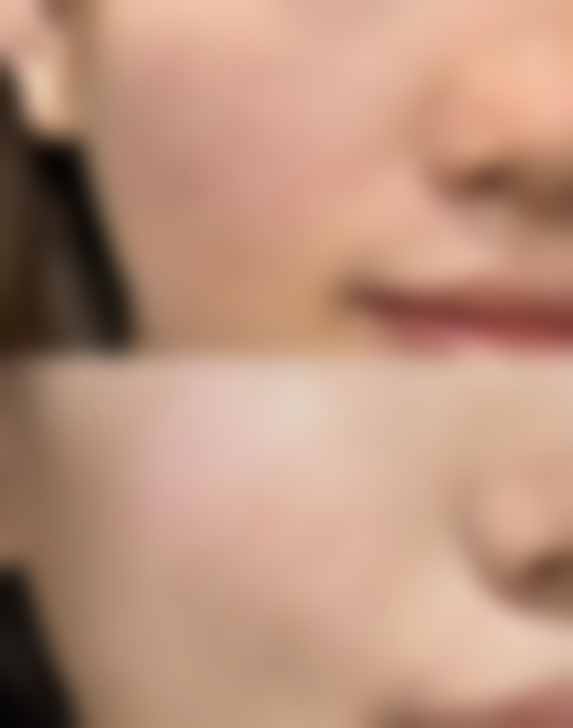 【罗秀平医生技术特点】