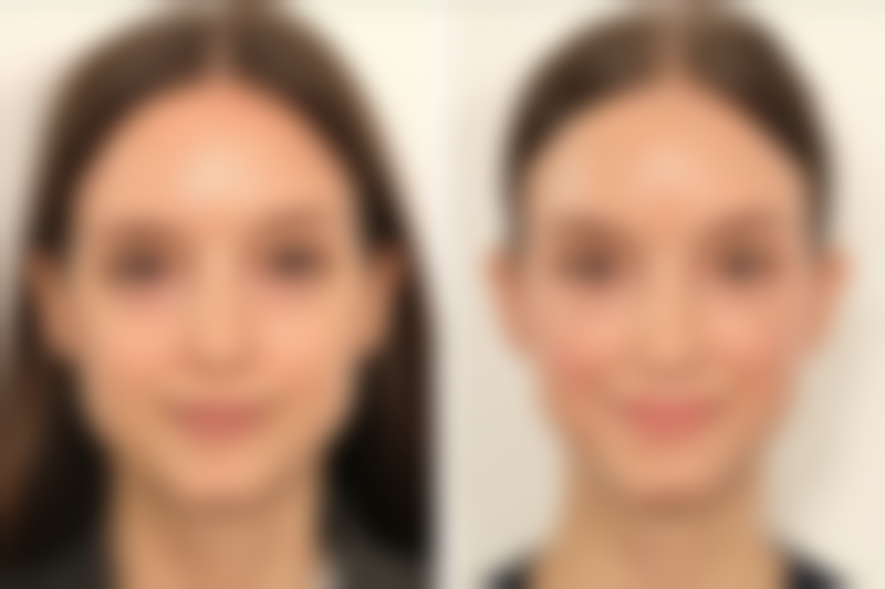 【长沙千和医疗美容门诊部特色项目：】