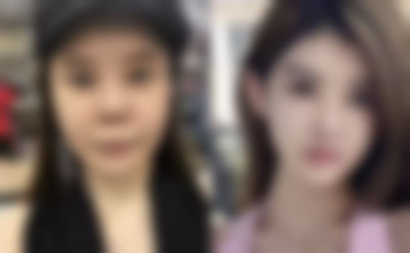 打除皱针多少钱一支