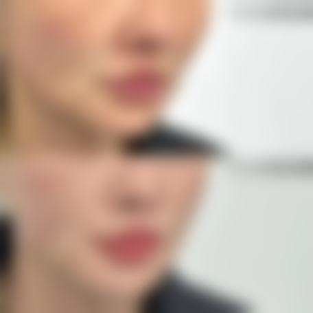 【济南隅美医疗美容诊所患者口碑评价：】