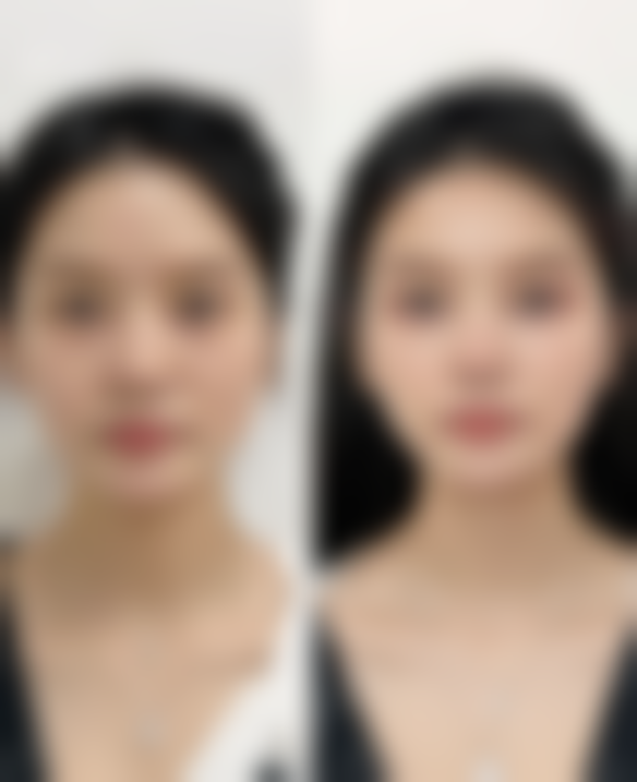 术后护理的重要性