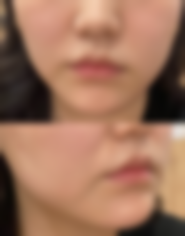 【济南隅美医疗美容诊所是正规的吗?】