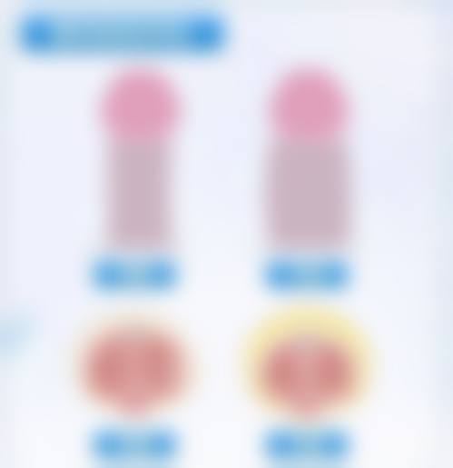 美白针哪种效果最好？揭秘 3 款超高口碑美白针，让你安全高效焕白，轻松拥有透亮美肌！ 