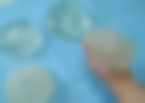 下巴整形成效更好的时候是?